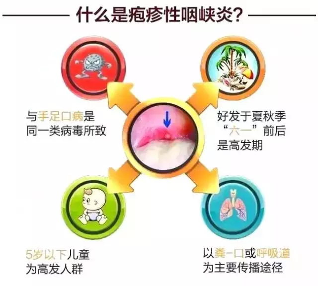 疱疹性咽峡炎2.png